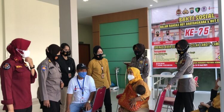 Hari Ke-3 Polda Kepri Bakti Sosial Operasi Bibir Dan Celah Langit-langit Dalam Rangka HUT Bhayangkara Dan HUT Dokkes Polri Ke-75.