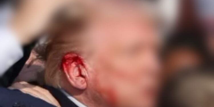 Mengungkap Penyebab Mantan Presiden Donald Trump Ditembak