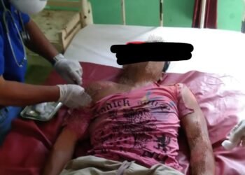 Truk Perusahaan PT.BHL Serempet Dua Pengendara Motor, Mengakibatkan Satu Orang Tewas