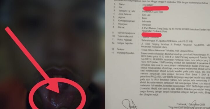 Miris,,!!! Kekerasan Terhadap Anak Santri Oleh Senior Terjadi di Pondok Pesantren Raudlatul Muhibbin