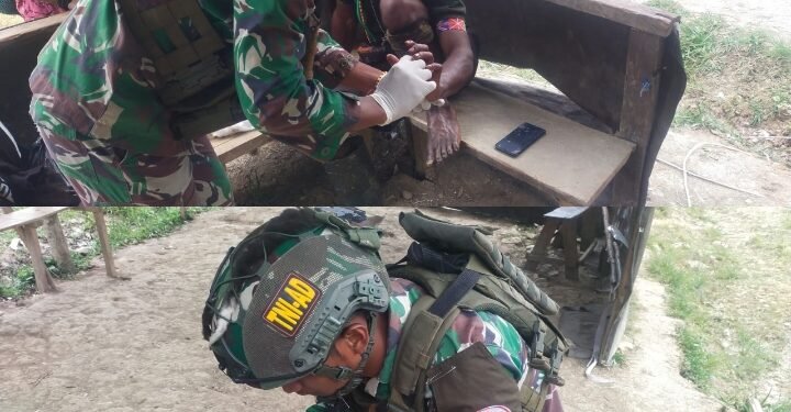 Satgas Yonif 323 Buaya Putih Obati Warga Yang Terluka Robek di Tangan