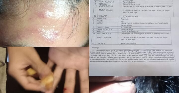 Suriadi Buat Laporan Polisi, Atas Kasus Pengeroyokan Terhadap Anaknya