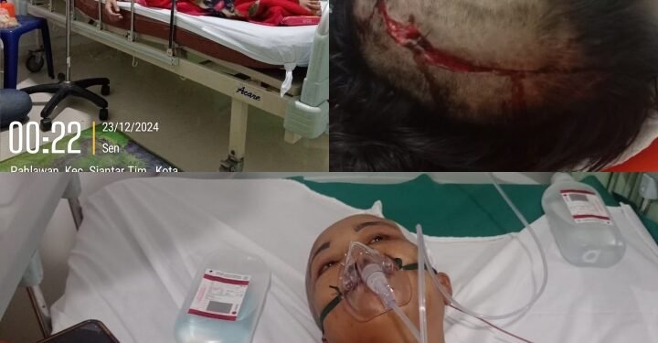Diduga Korban Penganiayaan, Seorang Wanita di Pangururan Mengalami Retak Batok Kepala dan Pendarahan Otak 