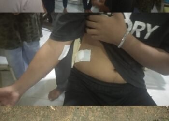 Ayah Tiri Tusuk Anak di Tempilang, Polres Bangka Barat Pastikan Pelaku Dalam Pengejaran