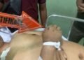 Polda Sumsel Kejar Tujuh Pelaku Pengeroyokan Sopir Truk di SPBU Noerdin Pandji Palembang