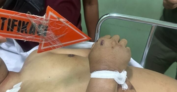 Polda Sumsel Kejar Tujuh Pelaku Pengeroyokan Sopir Truk di SPBU Noerdin Pandji Palembang